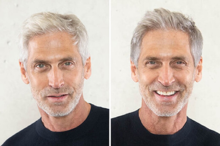 Grey Hair Blending For Male Hair Replacement Systems in London