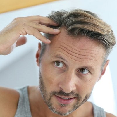 How To Reduce Male Hair Loss