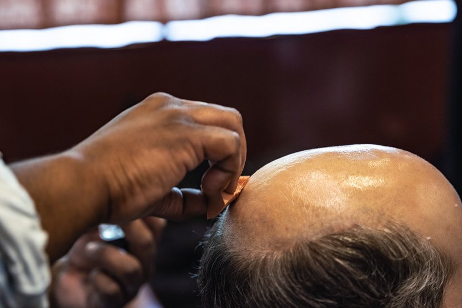 Men's Hair Replacement Systems in Holborn