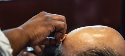 HAIR-LOSS-SYMPTOMS-AT-COCHRANE-AND-CO-SALON-IN-LONDON