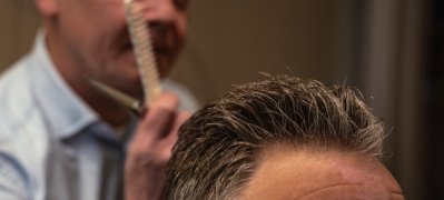 hair-replacement-for-men-in-central-London